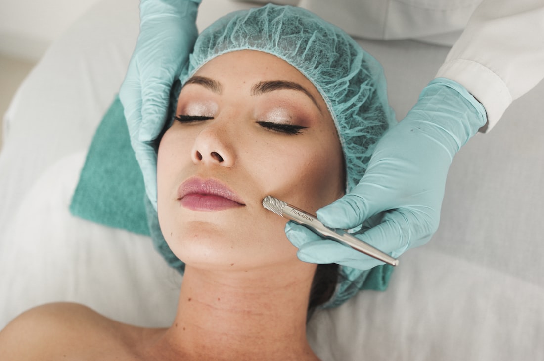 Microexfoliación facial